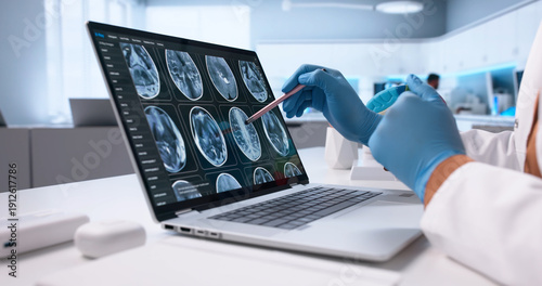 Konstfotografi Female Neuro Radiology Technician Diagnosing Brain Injury