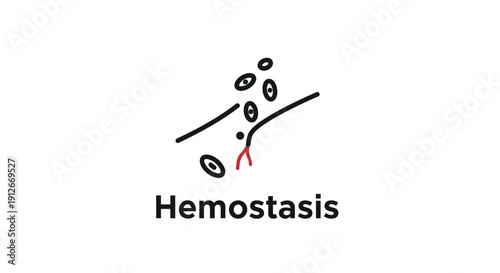 Hemostasis Diagram: Blood Clot Formation in a Vessel
