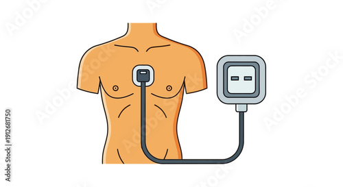 Holter Monitor or ECG Patch Attached to Male Chest. Cardiac Diagnostic Testing and Wearable Heart Health Device Illustration.