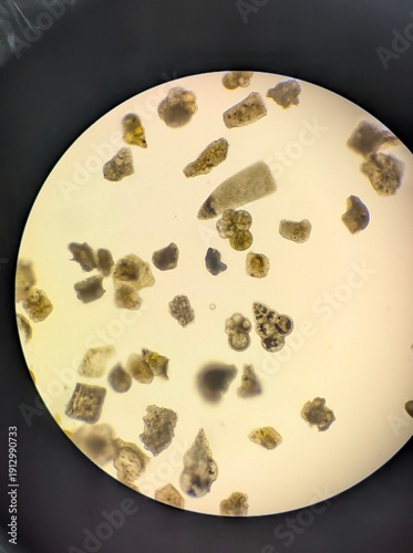 Obraz na plátně Light micrographs of foraminifera, unicellular protists with diverse shell-like tests
