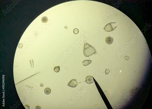 Fotografie Light micrograph of radiolaria, unicellular eukaryotic zooplankton found worldwide