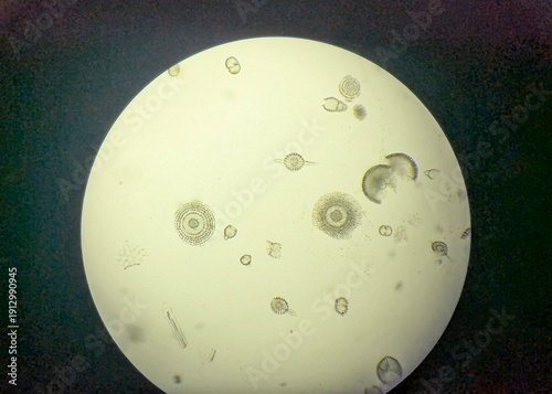 Fotografie Light micrograph of radiolaria, unicellular eukaryotic zooplankton found worldwide