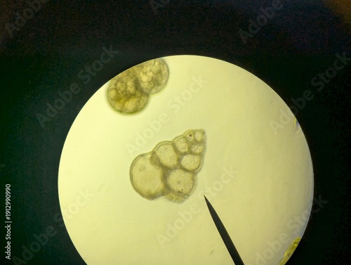 Fotografie Light micrographs of foraminifera, unicellular protists with diverse shell-like tests