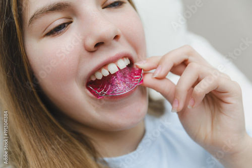 Close up of teenage girl hands placing pink removable orthodontic plate on teeth, pediatric dentistry and self-care during bite correction treatment concept