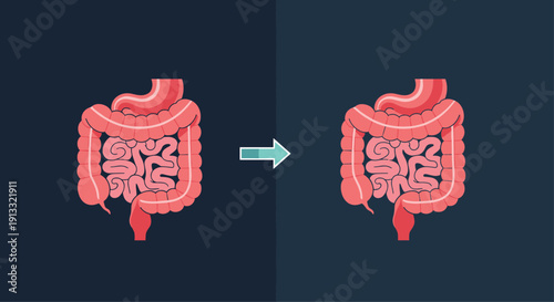 Simple before-and-after illustration showing the human digestive system or intestines, useful for medical or health presentations.