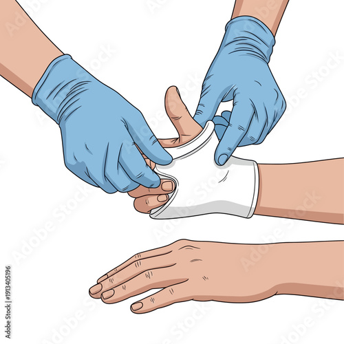 Medical professional applying a thumb splint on a patient's injured hand for recovery