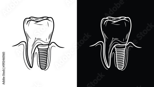 An illustration depicts a human molar tooth shown in both positive and negative contrast
