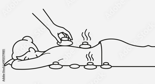 Cupping Therapy on a Persons Back for Relaxation.