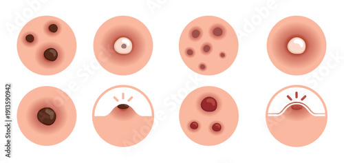 pimple icons vector
