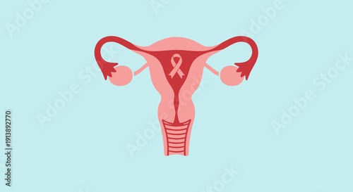 Illustration of the female reproductive system highlighting the uterus with a ribbon symbol