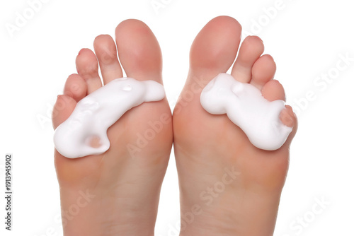 Εκτύπωση καμβά Close-up of a woman’s bare feet with foam applied to toes, concept of footcare and hygiene, studio shot on a white background