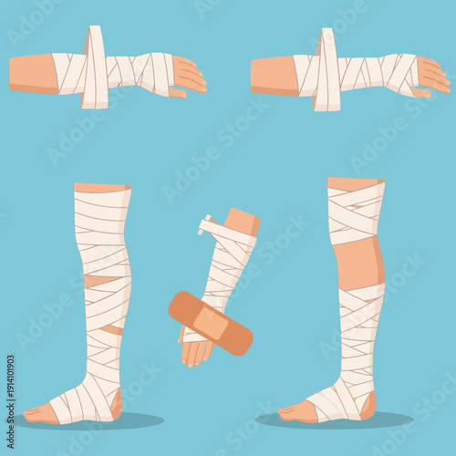 Medical Bandages Applied to Human Limbs for Injury Treatment.