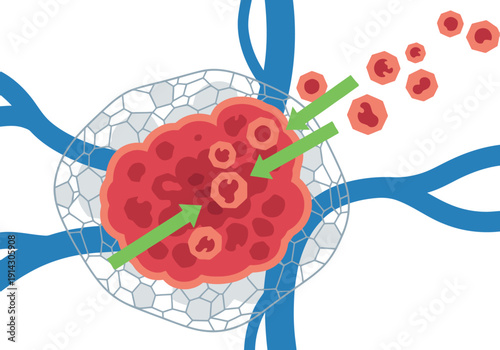 Cell therapy targets cancer cells. Green arrows indicate cell migration towards a tumor. Illustrative diagram for medical concepts.