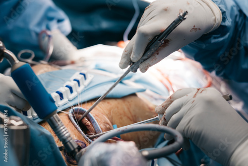Obraz na plátně Cardiovascular operation on heart with sterile surgical environment and professional medical staff