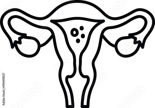 Simple line drawing of a female reproductive system with ovaries and uterus.