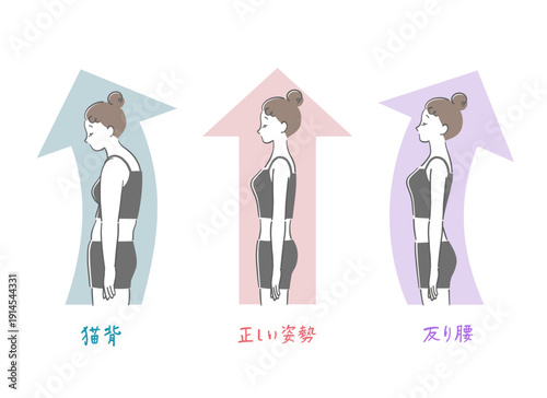 正しい姿勢と猫背と反り腰の女性の比較イラストセット