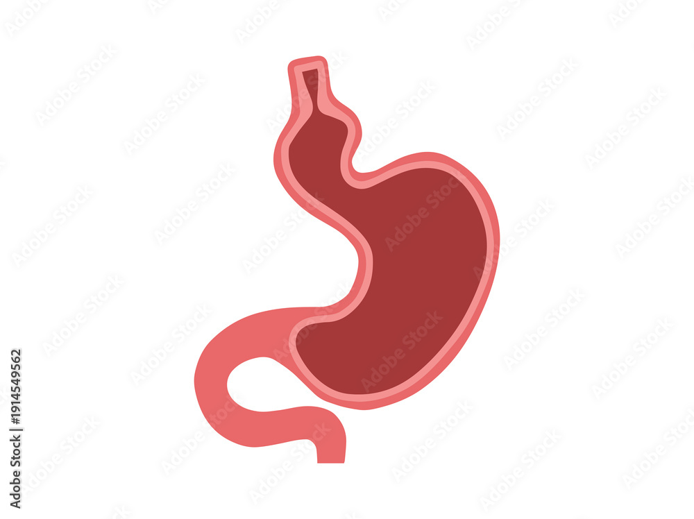 Fototapeta premium Hiatal Hernia Disease Stomach Illustration 
