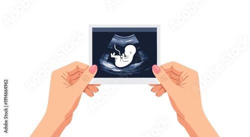 Baby Ultrasound Image Vector Illustration Held in Hands - Artistic Representation of Fetal Development and Pregnancy Journey