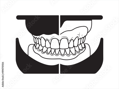 Medical illustration of human teeth in dental impression mold