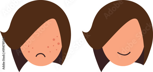 Flat Style Vector Illustration of Girl Faces Showing Acne Transformation