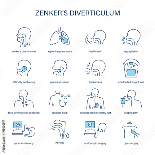 Zenker's Diverticulum symptoms, diagnostic and treatment vector icon set