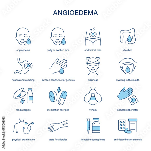 Angioedema symptoms, diagnostic and treatment vector icon set