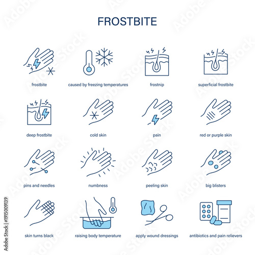 Frostbite symptoms, diagnostic and treatment vector icon set