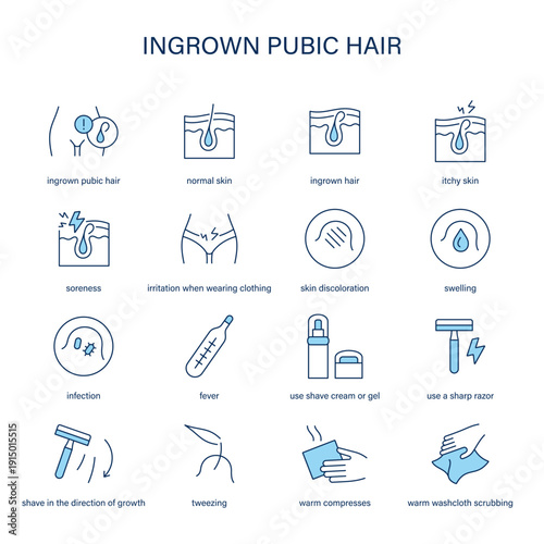 Ingrown Pubic Hair symptoms, diagnostic and treatment vector icon set