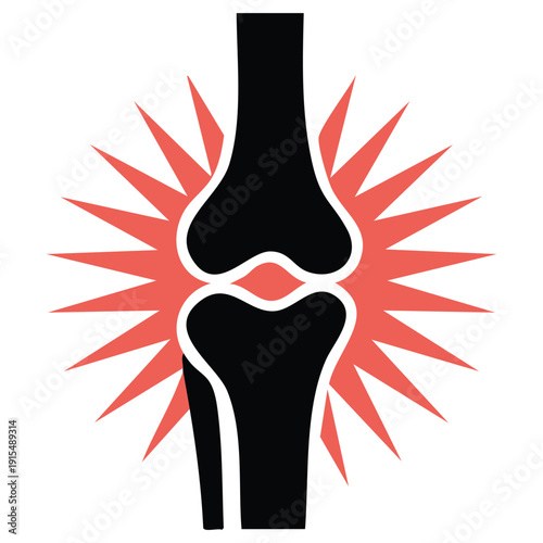 Medical illustration of painful knee joint with inflammation for healthcare and orthopedic concepts