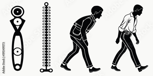 Illustration depicting the stages of scoliosis progression and treatment Vector