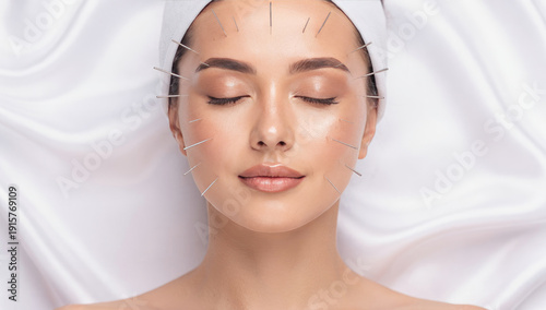 Holistic Healing: Close-Up of a Beautiful Woman Receiving Facial Acupuncture for Wellness and Radiance