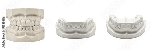 Photos Dental plaster mold of teeth isolated on white background, gypsum dental cast mo