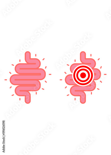Pink digestive system symbols showing a healthy gut and an inflamed area with a red target to represent stomach ache, cramps, or medical issues.