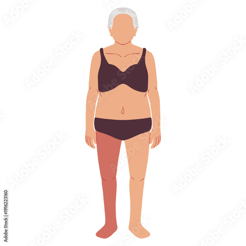 human stroke paralysis types medical Illustrations