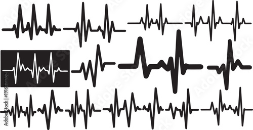 Collection of various ECG heartbeat waveform patterns and tracings