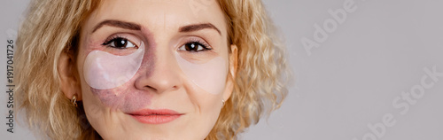 Photos Woman with visible port-wine stain birthmark vascular skin condition wearing  hy