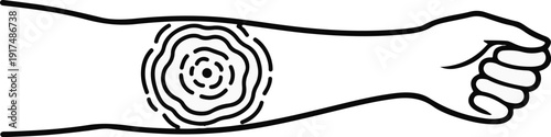 Black and white illustration of a clenched fist holding an arm with concentric circles on it