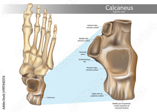 High-detail medical illustration of the human calcaneus shown in superior view, alongside a contextual foot skeleton. Calcaneus Bone Superior View