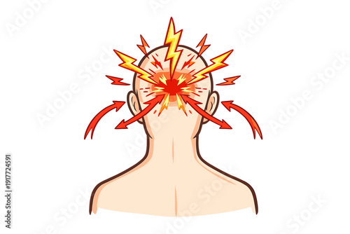An illustration of the back of a human head with red and yellow lightning bolts and arrows pointing inward, symbolizing a severe headache, migraine, or intense mental pressure.