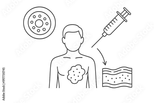 A black and white line art illustration depicting a human torso with a skin lesion, a petri dish, a medical syringe, and a cross-section of skin layers for medical research.