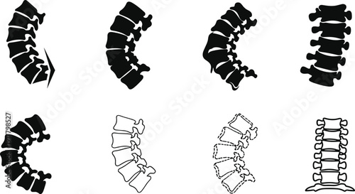 Spine anatomy in various styles and orientations vertebrae medical skeletal