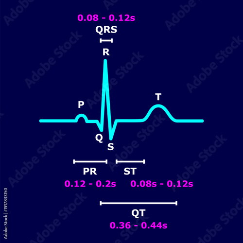 Normal ECG sinus rhythm with labeled P wave, QRS complex, T wave, PR interval, ST segment, and QT interval including standard duration values. Medical educational diagram of electrocardiogram. Vector.