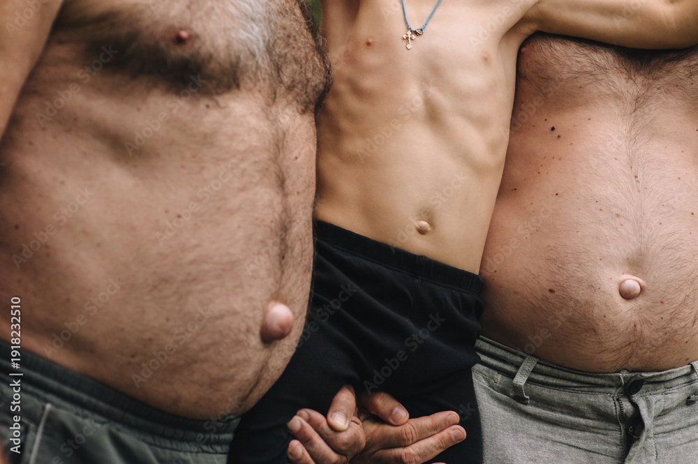 Naklejka premium Photograph, portrait of a family, three people with hereditary umbilical hernias. Concept of illness.