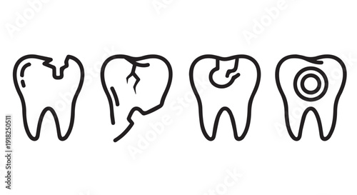Four illustrations of teeth with various dental problems, including cracks, chips, and cavities on Transparent Background.