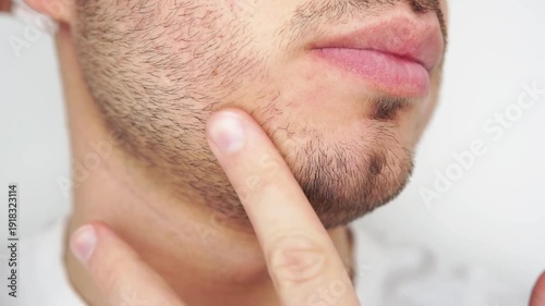 Young man applying beard growth oil with pipette close up