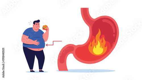 Obese man holding a burger and his stomach in pain, with an illustration of a burning stomach, symbolizing heartburn from unhealthy eating.