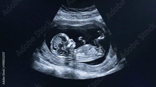 Ultrasound Image of Fetus in Womb Showing Developmental Stages