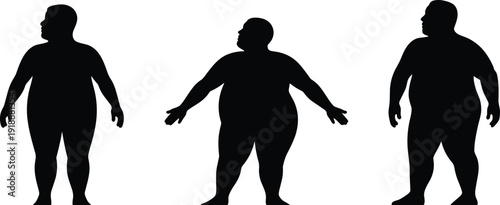 Obese man silhouette vector set with front and side standing poses, overweight male body shape icons isolated on white background