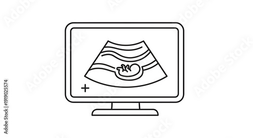 Ultrasound Scan Showing Fetus on Monitor Screen, Medical Technology