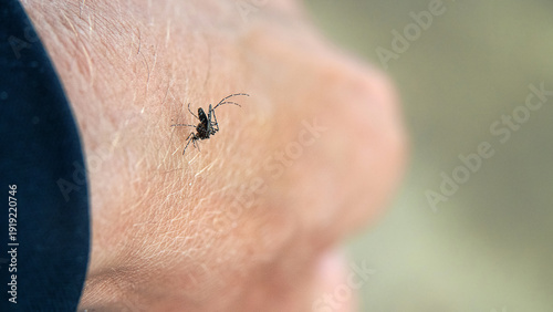 Photos Vector of human diseases